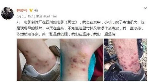 淑芳两腿间又痒了50岁网友：可能是更年期症状，建议就医检查一下