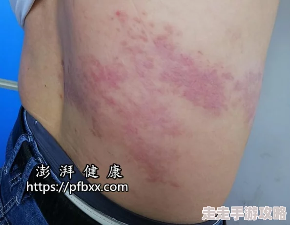 黄色软件下载链接存在安全隐患谨防病毒和诈骗风险